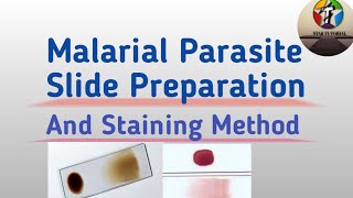 Malarial Parasite Slide Preparation And staining Method [upl. by Bethina62]