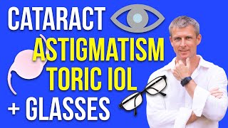 Cataract astigmatism toric IOL glasses and IOL selection [upl. by Sudderth]