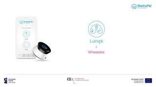 Lungs auscultation  wheezes 1 [upl. by Zorina]