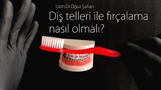 UzmDrOğuz Şahan  Diş telleri ile nasıl diş fırçalanır Diş telleri nasıl temizlenir [upl. by Ayela618]