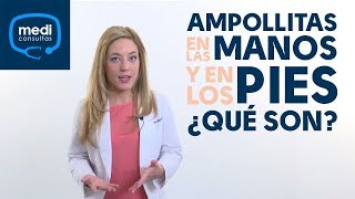 ❌ COMO CURAR UNA AMPOLLA EN EL PIE de MANERA CASERA 😷 TUTORIAL de SALUD para TRATAR AMPOLLAS  L4F [upl. by Methuselah]