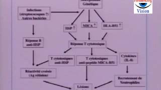 Les Symptômes de la Maladie de Behçet [upl. by Htebiram]