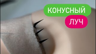 КОНУСНЫЙ ЛУЧ ✅ [upl. by Bern]