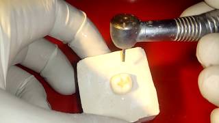 demonstration of conventional class 1 cavity preparation on mandibular molar for amalgam filling [upl. by Lorrin895]