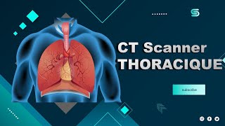 CT Scanner THORACIQUE Sans Injection  Partage de Pratiques [upl. by Spalding]