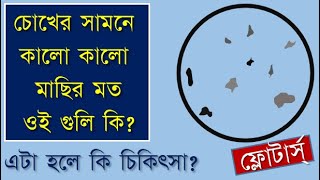 What are Floaters in eyes causes and treatment eyefloaters eyeflashesdrbhaskarDey [upl. by Starks]