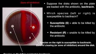 Disk Diffusion Test using Bacitracin or Optochin [upl. by Eben]