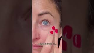 How to get rid of dark circles [upl. by Marras]