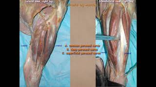 LA Muscle amp Nerves of Crus [upl. by Dorelia]