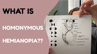 What is Homonymous Hemianopia [upl. by Netsrejk25]