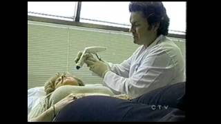 ThermaLift Skin Tightening Procedure on CFTO News Toronto  SpaMedicaTV [upl. by Yuh]