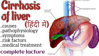 Cirrhosis of the liver in hindiliver cancerलिवर की बीमारी  Nursing education [upl. by Deehsar32]