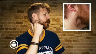 How To Deal With Beard Cowlicks [upl. by Sharia]