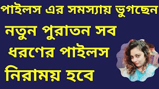 Say goodbye to piles  Piles treatment without surgery  অর্শ   Piles treatment homeopathic [upl. by Kiki361]