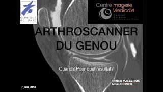 Arthroscanner du genou Alban ROMIER [upl. by Garold]