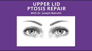 Upper Lid Ptosis Repair [upl. by Gamber]