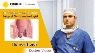 Hemorrhoids  Dr Rajesh Vunnamatla  Advanced Laparoscopic amp General Surgeon [upl. by Ennyrb]