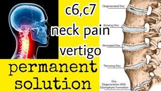 C6C7 neck pain  simple therapy very easy to do and sure results [upl. by Karub645]