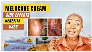 MELACARE CREAM amp SKIN WHITENING HOW TO USE BENEFITS amp SIDE EFFECTS [upl. by Annoynek818]