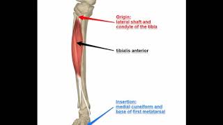 Tibial plateau fracture Signs symptoms and current treatments [upl. by Clynes]