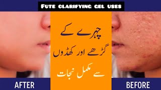 Fute clarifying gel use l treatment of acne amp dul skin l bnft amp effect ful revew by aneespharmacist [upl. by Noynek]