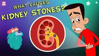 What Causes Kidney Stones  The Dr Binocs Show  Best Learning Videos For Kids  Peekaboo Kidz [upl. by Wolfram154]