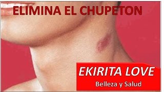 ELIMINA CHUPETON CHUPETE SUGILACION  Ekirita Love [upl. by Nosirb]