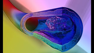 Galectin3 binds the Transferrin Receptor amp Kills TCells  Failed Biochemist Season 2020 ep 61 [upl. by Eimiaj]