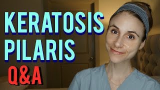 KERATOSIS PILARIS QampA WITH A DERMATOLOGIST Dr Dray [upl. by Marentic]