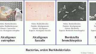 Bacterias orden Burkholderiales faecalis cepacia bronchiseptica Alcaligenes Comamonadaceae Heads [upl. by Fortune]