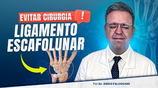 Evitar cirurgia para o ligamento escafolunar [upl. by Shayn]