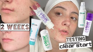 TESTING DERMALOGICA CLEAR START SKINCARE ON MY ACNE FOR 2 WEEKS [upl. by Swor]