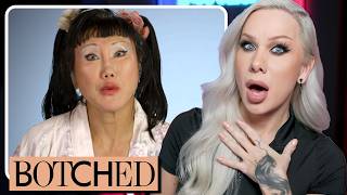 BOTCHED Can transracial plastic surgeries be reversed volume 1 [upl. by Marte]