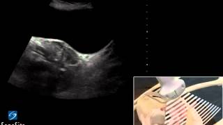 3D Cómo hacer Examen ecográfico de la Pelvis en Mujer  Ultrasonido SonoSite [upl. by Odlopoel]