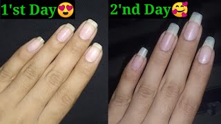 How to Grow Nails in 2 Days  How to Grow Nails Fast [upl. by Norret483]