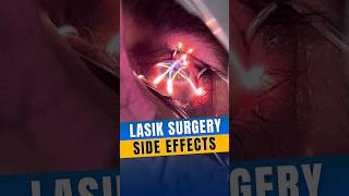 Side Effects Of Lasik Surgery [upl. by Atul]