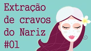 Extração de cravos do Nariz 01  Limpeza de Pele Profunda  Clínica  Centro estética [upl. by Mira138]