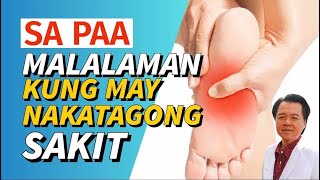 Sa Paa Pwede Makita kung may Nakatagong Sakit  By Doc Willie Ong [upl. by Nahtnanhoj]