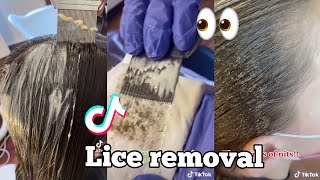 lice removal tiktok compliation‼️👀☹️ [upl. by Celina166]