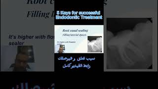 5 Keys for successful Endodontic Treatment endodontics endodontictreatment الكربولة dentist [upl. by Elnukeda563]