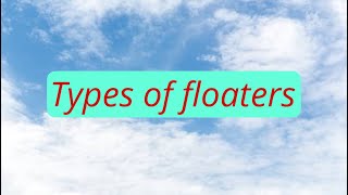 Types of eye floaters [upl. by Ijan562]