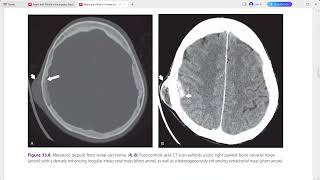 RADIOLOGY EXAM CASES [upl. by Celestyn]