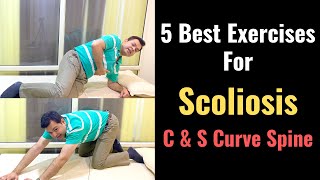 5 Best Exercises for Scoliosis How to Correct Scoliosis Stretches for Scoliosis Spinal Curvature [upl. by Ailelc]