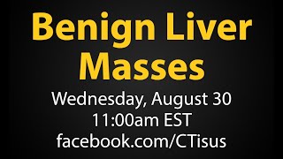 Facebook Live Benign Liver Masses [upl. by Byron]