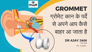 quotबच्चे के कान से निकाला Grommet देखें” grommet glueear [upl. by Enaols]