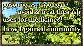 Poison ivy  oak  sumac ID remedies medicinal uses amp immunity [upl. by Aloisius]