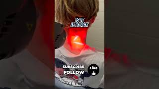 Class 4 laser therapy is easing neck pain after a car accident Start your recovery now 💪 [upl. by Tarrsus]