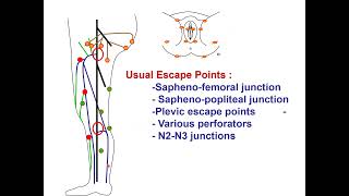 Venous hemodynamics physiopathology and treatments CFranceschi BARI 2024 [upl. by Parrott]