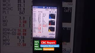 CBC  Haemogram  CBC Test cbc lab rbc shorts viral ytshorts [upl. by Assirrec]