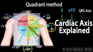 Cardiac Axis Interpretation Animation [upl. by Maclean]